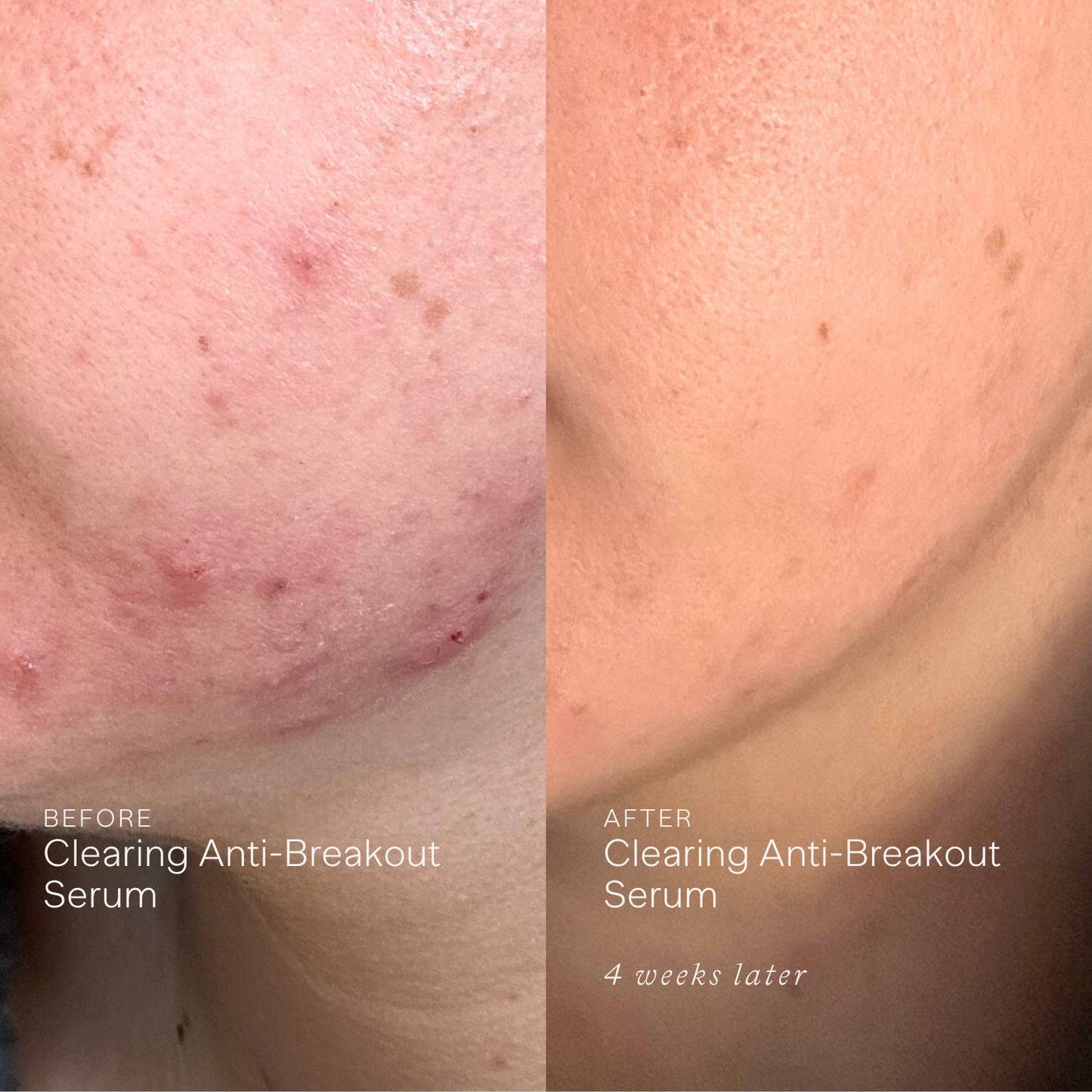 Anti-Breakout Starter Routine