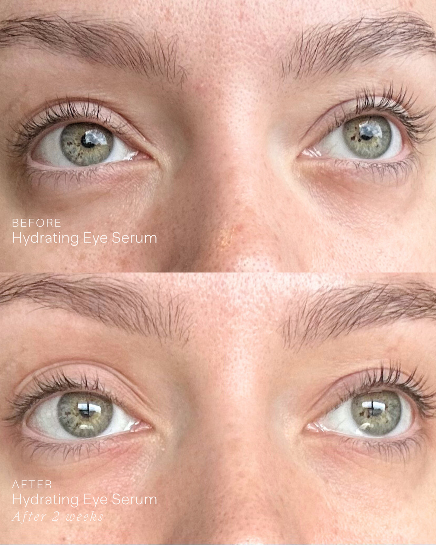Hydrating Eye Serum