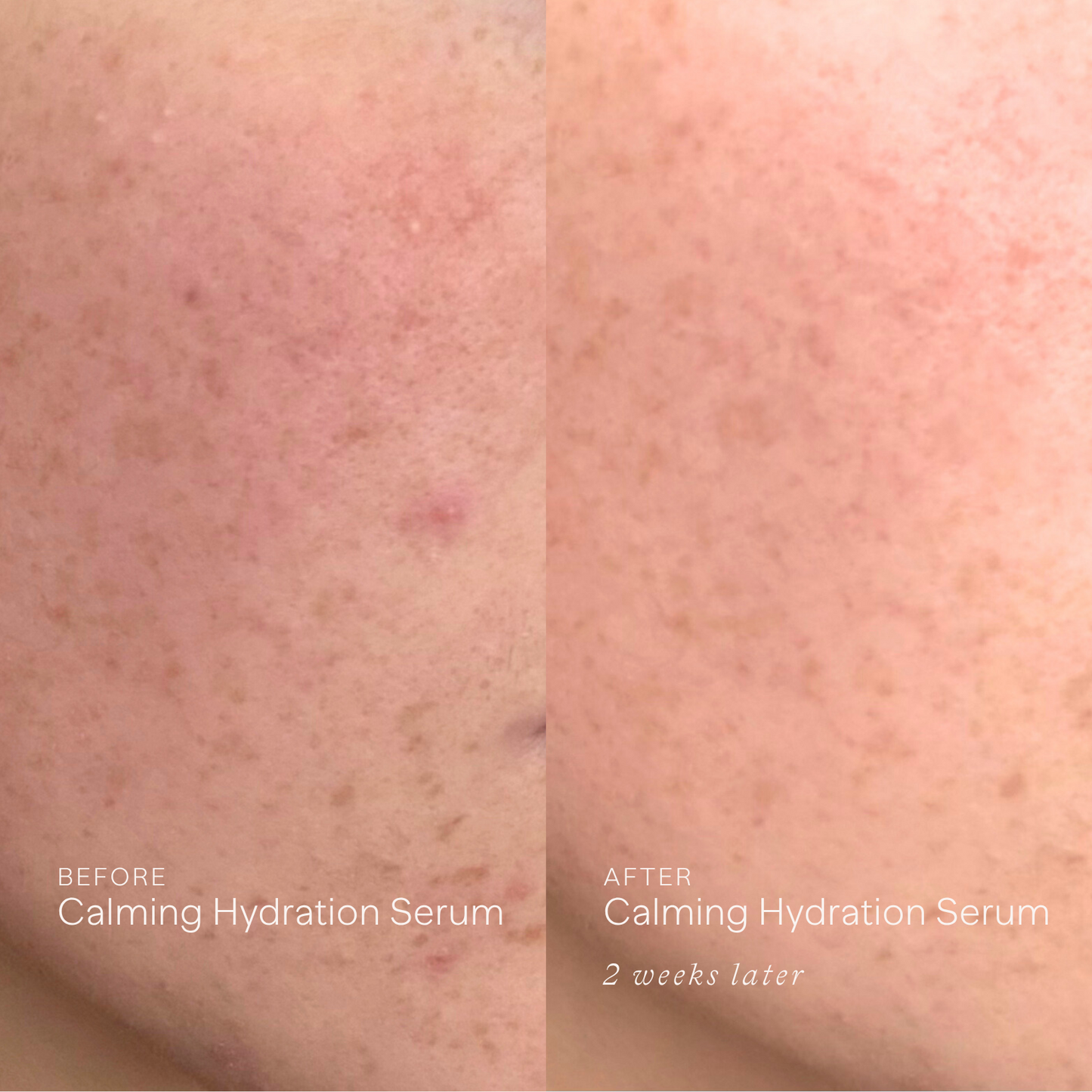 Anti-Redness - AM Routine