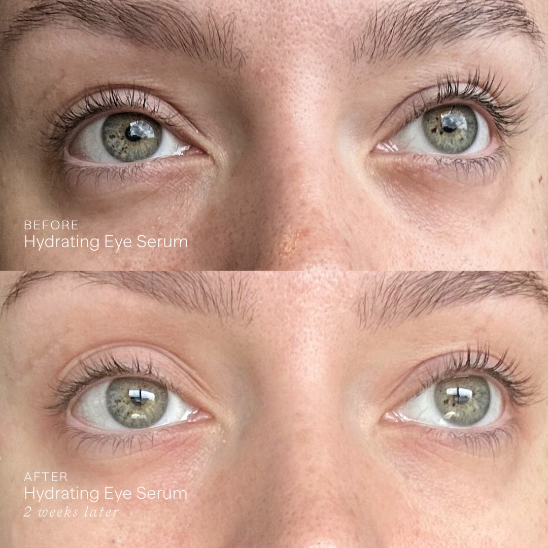 Hydrating Eye Serum