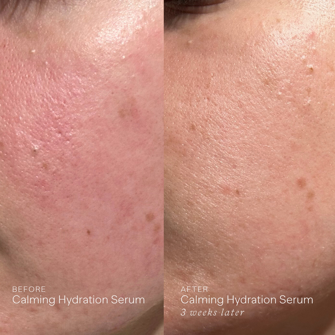 Calming Hydration Serum
