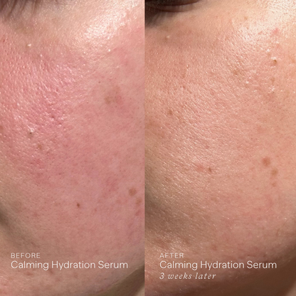 Calming Hydration Serum
