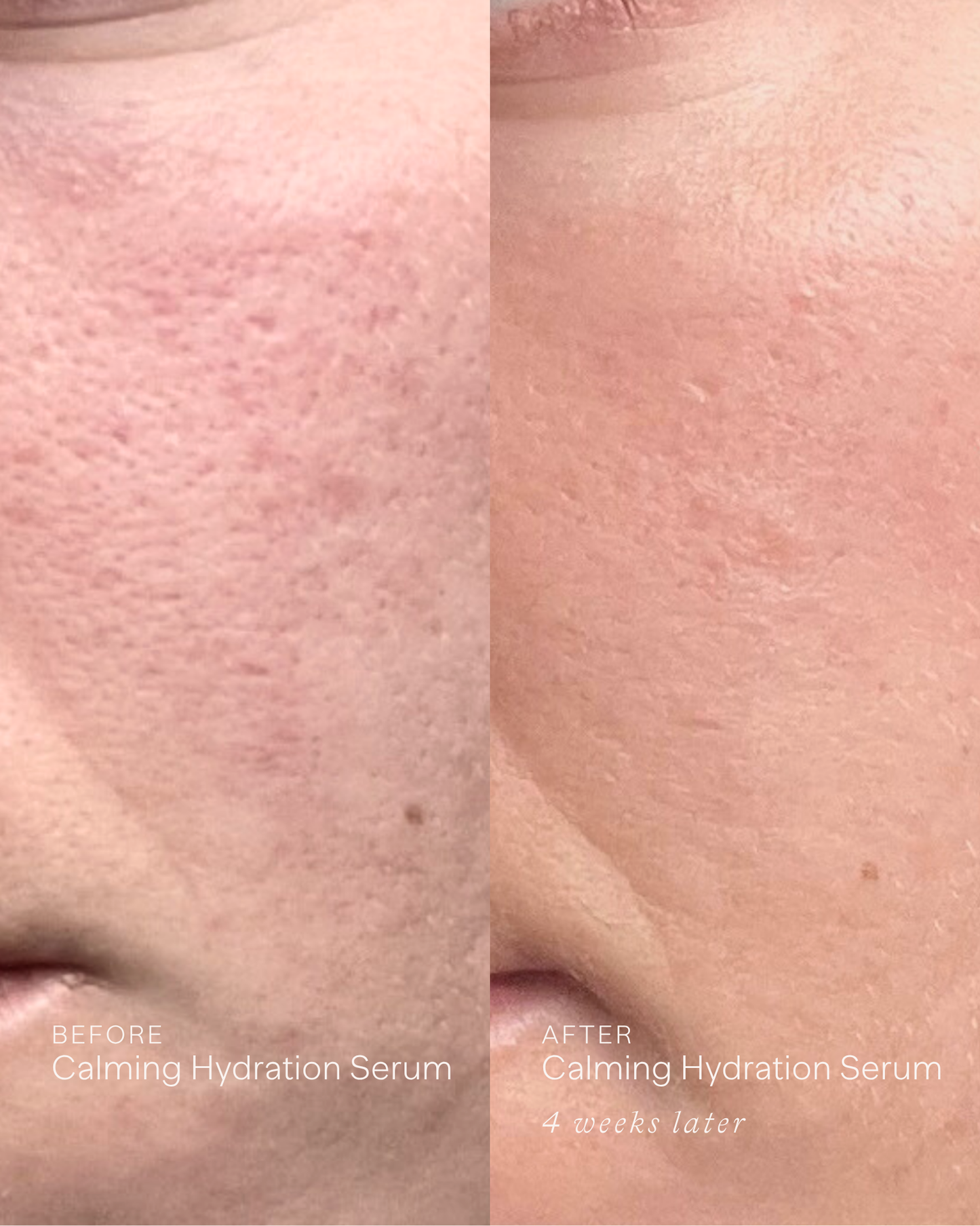 Calming Hydration Serum