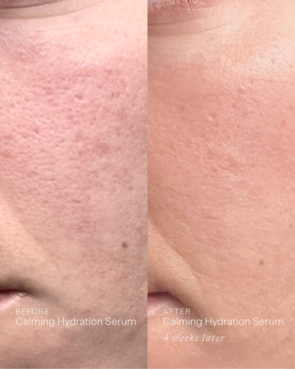 Calming Hydration Serum